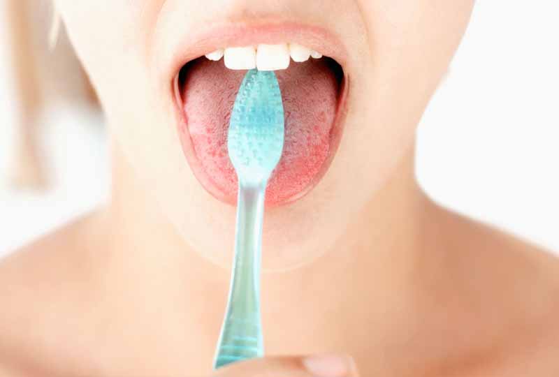 Lưỡi sạch sẽ cũng giúp hạn chế vi khuẩn gây bệnh viêm lợi