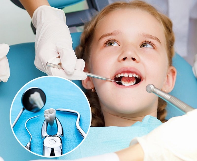 Nhổ răng sữa cho trẻ bao nhiêu tiền là thắc mắc chung của các bậc phụ huynh khi con đến kỳ thay răng