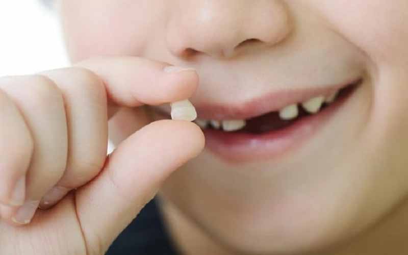 Chi phí nhổ răng sữa ở trẻ không cố định 