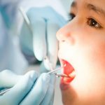 Nên thăm khám nha khoa trước khi quyết định nhổ răng cho trẻ