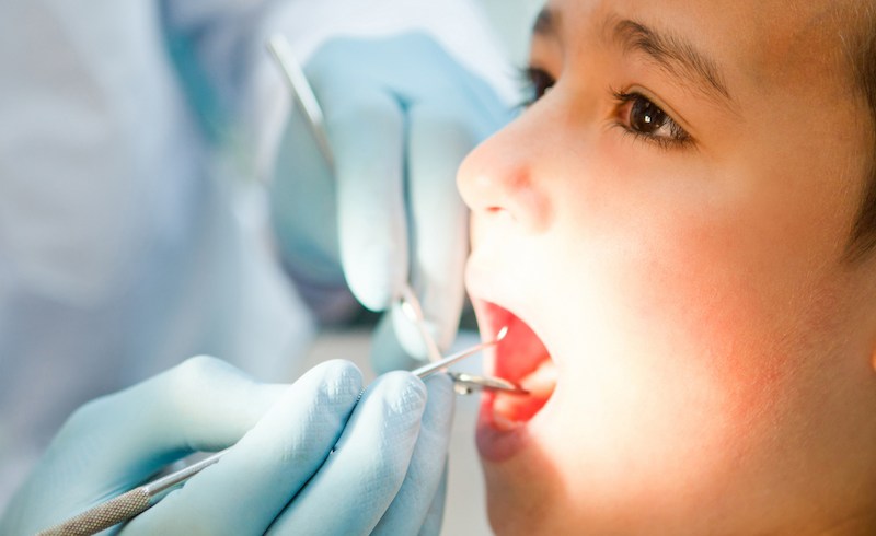 Nên thăm khám nha khoa trước khi quyết định nhổ răng cho trẻ