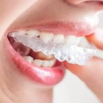 Niềng răng Invisalign áp dụng từ 1 - 2 năm mới có hiệu quả