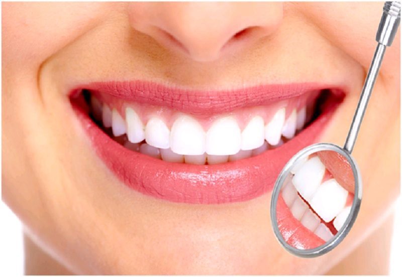 Bọc răng sứ là phương pháp nha khoa thẩm mỹ được nhiều người lựa chọn hiện nay