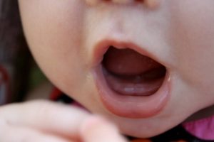 Thông thường chiếc răng đầu tiên của trẻ mọc vào tháng tuổi thứ 6