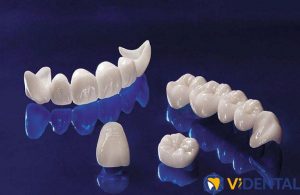 Công nghệ chế tác răng sứ số 1 Việt Nam