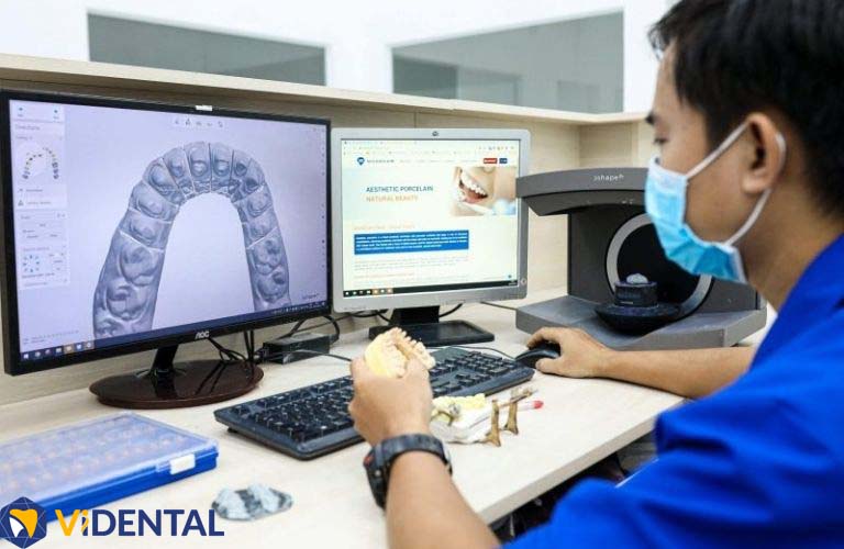 Công nghệ CAD/CAM tại ViDental tạo nên dáng răng, màu răng chuẩn xác