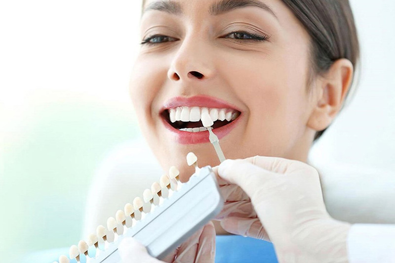 Địa chỉ uy tín giúp bạn sở hữu hàm răng hoàn hảo, tối ưu chi phí