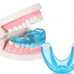 Niềng răng trainer cho người lớn là gì? Tốt hay xấu?