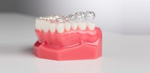 Niềng răng vô hình Clear Aligner là 1 trong 3 phương pháp chỉnh nha không mắc cài phổ biến nhất