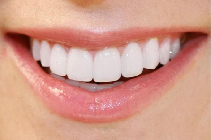 Tiêu chuẩn của hàm răng đẹp  Nha khoa Paris