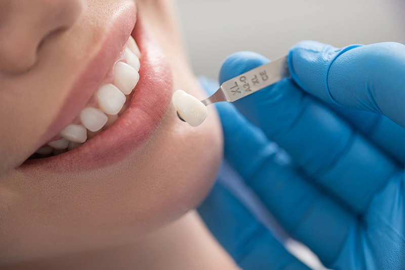 Nếu bạn mắc bệnh răng miệng, chi phí bọc răng có thể sẽ phát sinh