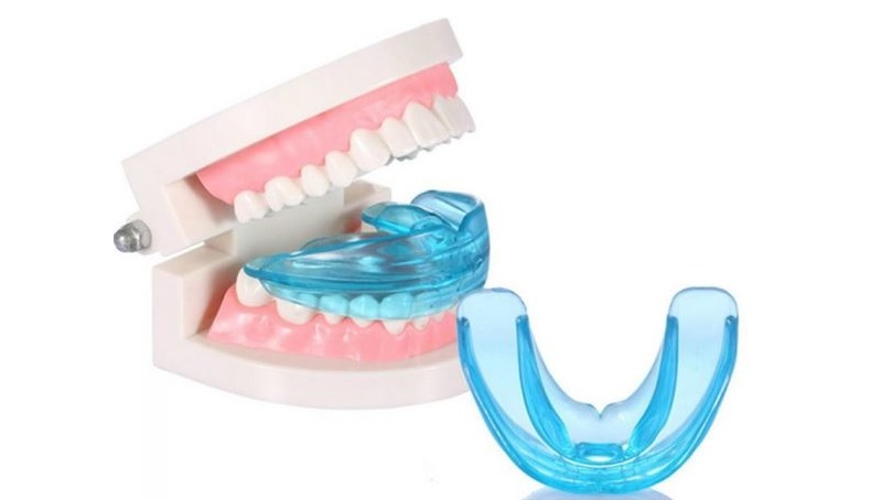 Máng nhựa điều chỉnh răng tại nhà tiện dụng