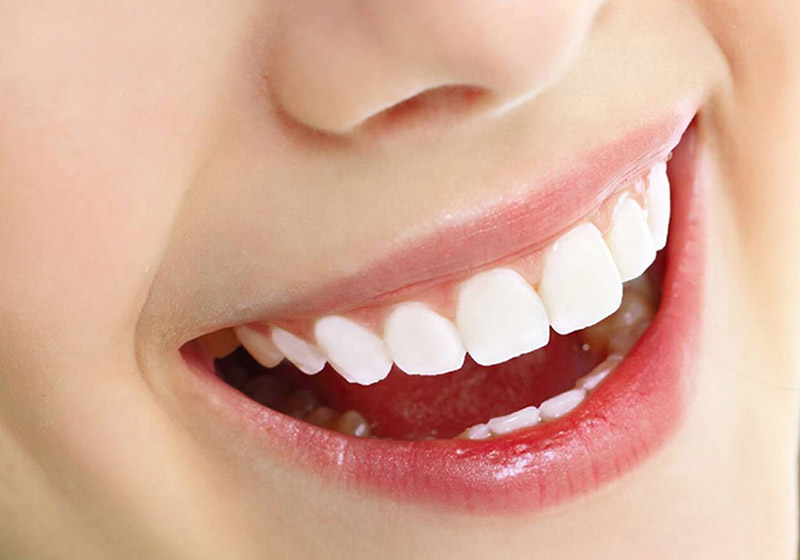 Dịch vụ bọc răng sứ Zirconia cho hiệu quả thẩm mỹ cao
