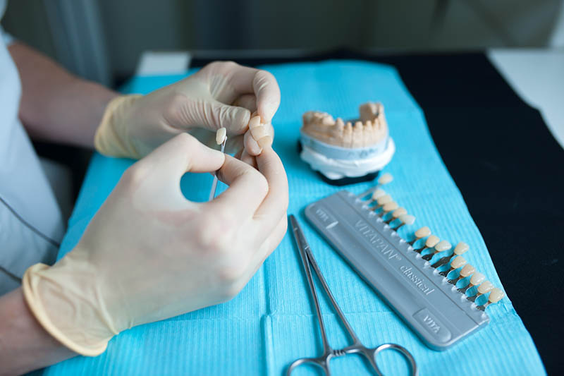Răng sứ Zirconia sở hữu nhiều ưu điểm, được nhiều nha sĩ đánh giá cao