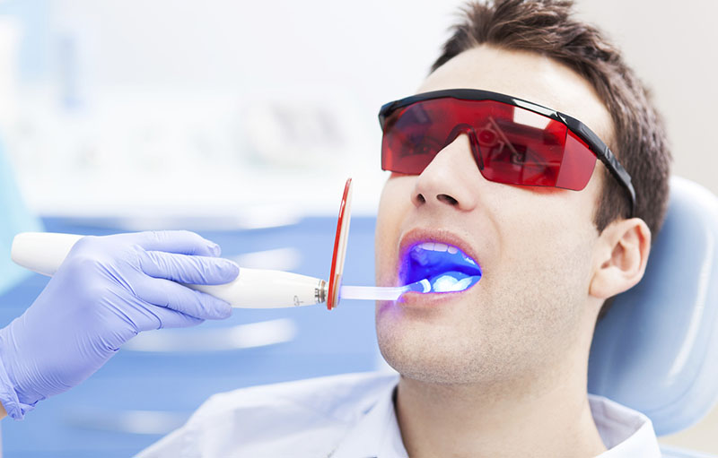 Quy trình chuẩn khi tẩy trắng răng tại nha khoa