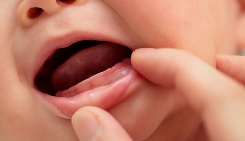 Những dấu hiệu cho thấy trẻ bắt đầu mọc răng