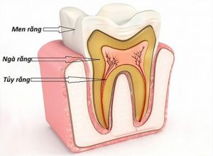 men răng là gì