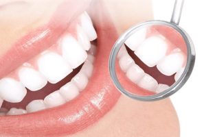 Trồng răng sứ mất bao lâu còn tùy thuộc vào từng đối tượng khách hàng. Nó có thể kéo dài 2-3 ngày cũng có thể lâu hơn nếu có sự cố phát sinh.