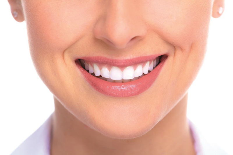 Bọc răng sứ nguyên hàm mang đến rất nhiều lợi ích cho người thực hiện, đặc biệt là yếu tố thẩm mỹ