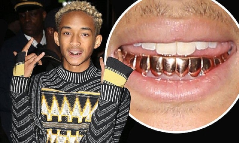 Con trai tài tử Will Smith sở hữu những chiếc răng bọc vàng