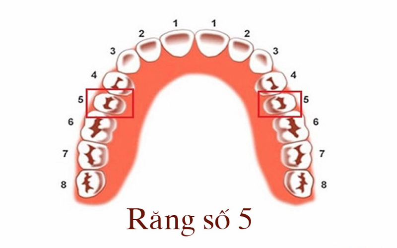 Vị trí của răng số 5 dựa trên sơ đồ cung hàm