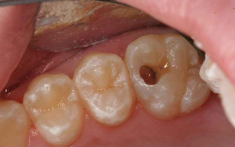 Nếu bạn đang gặp vấn đề về răng miệng cần được điều trị trước khi tiến hành