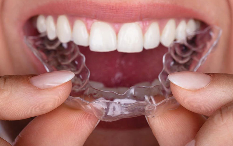 Niềng răng trong suốt có nhiều thương hiệu khác nhau