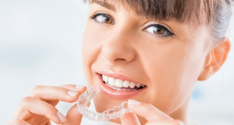 Giá niềng răng Invisalign thường cao hơn so với các phương pháp chỉnh nha truyền thống khác