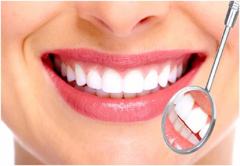 Trồng răng sứ là một phương pháp giúp bạn sở hữu một hàm răng trắng đẹp tự nhiên 