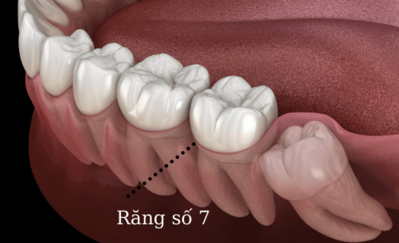 Răng số 7 là răng hàm lớn đảm nhận việc nhai, nghiền thức ăn