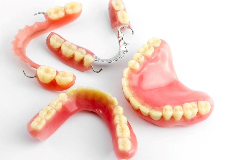 Răng giả tháo lắp cũng được sử dụng trong trồng răng số 7