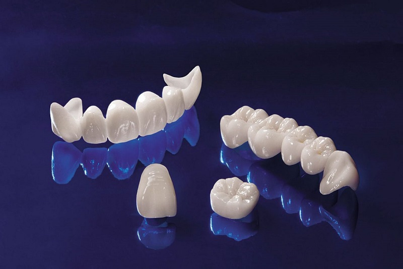 Răng toàn sứ Cercon được xem là loại răng sứ tốt nhất hiện nay