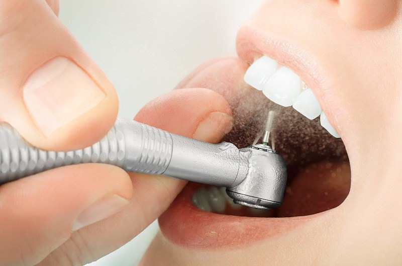 Quy trình trồng răng được diễn ra cụ thể theo hướng dẫn của bác sĩ