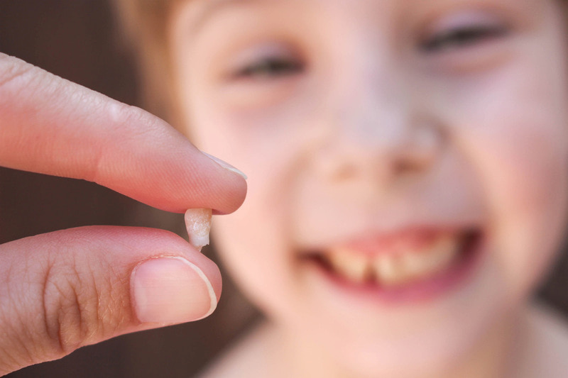 Sâu răng nếu không xử lý kịp thời có thể khiến trẻ bị mất răng vĩnh viễn