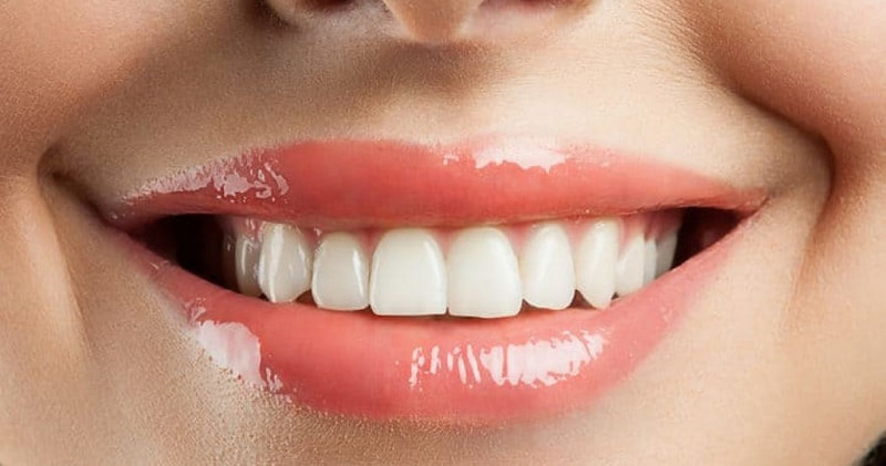 Răng cửa có ảnh hưởng rất lớn đến thẩm mỹ gương mặt