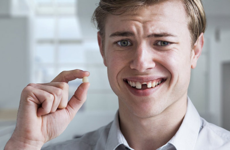 Mất răng cửa có thể gây ra nhiều vấn đề đối với cung hàm và khả năng nhai