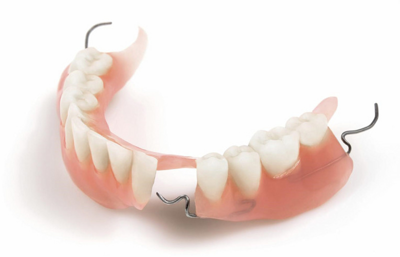 Trồng răng cửa bằng hàm tháo lắp không cải thiện được nhiều về khả năng nhai