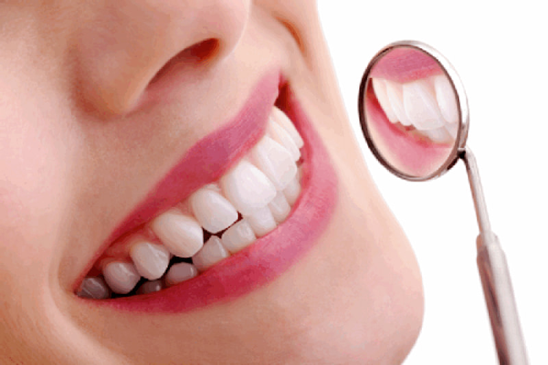 Chi phí trồng răng có thể phụ thuộc vào chất liệu và số lượng răng cần làm