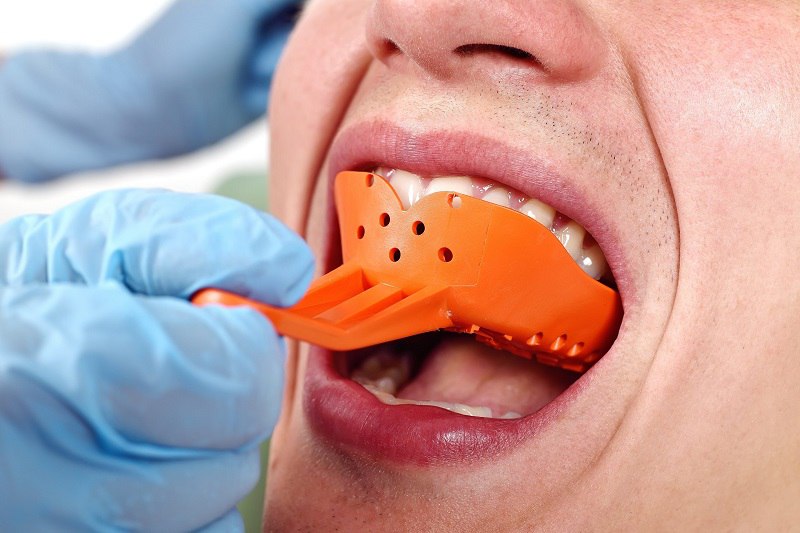 Răng giả tháo lắp không giúp cải thiện khả năng nhai