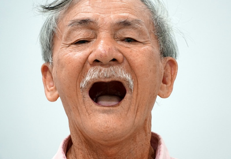 Người cao tuổi có thể bị răng yếu và gãy rụng nhiều