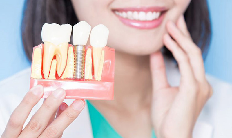 Trồng răng giả vĩnh viễn với implant được đánh giá là không gây đau đớn hay khó chịu