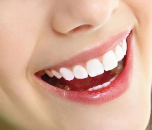 Bọc Răng Sứ Có Bền Không? Cách Giúp Duy Trì Độ Bền Của Răng Sứ