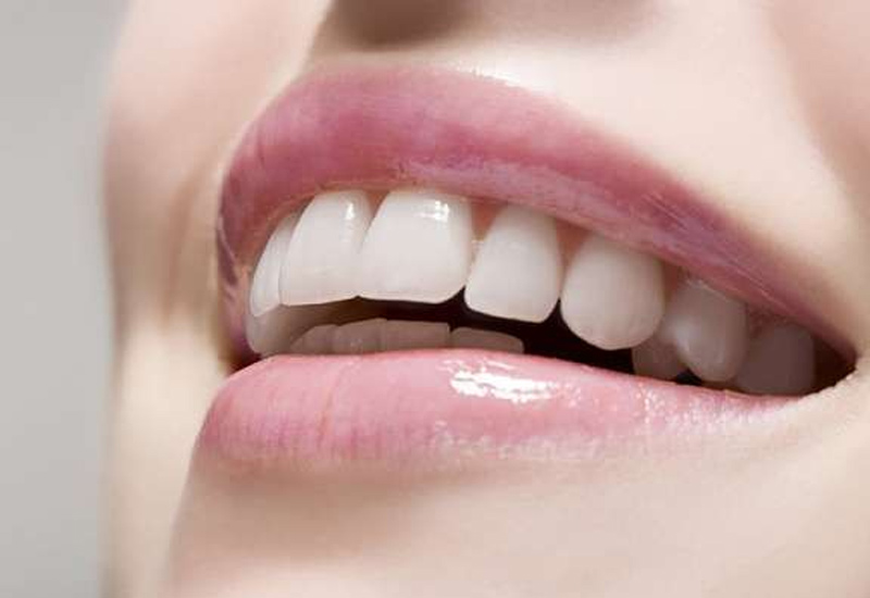Bọc răng sứ có được vĩnh viễn không là thắc mắc của rất nhiều người
