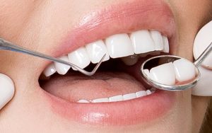 Bọc Răng Sứ Có Hết Móm Không? [Giải Đáp Từ Chuyên Gia]