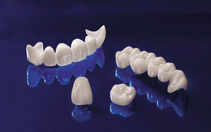 Giá răng sứ phụ thuộc vào nhiều yếu tố quyết định