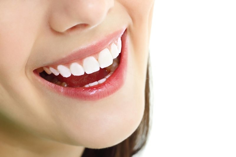 Răng sứ là một trong những phương pháp thẩm mỹ nha khoa được nhiều người ưa chuộng