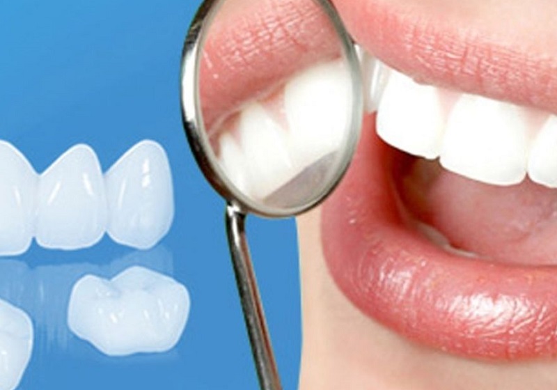 Lấy dấu, đổ mẫu đúc là khâu quan trọng trong làm răng sứ