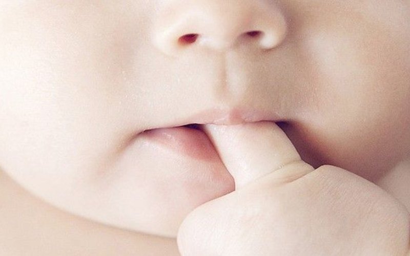 Răng sữa bị hô hàm trên do nhiều nguyên nhân gây ra ví dụ như thói quen ngậm ngón tay