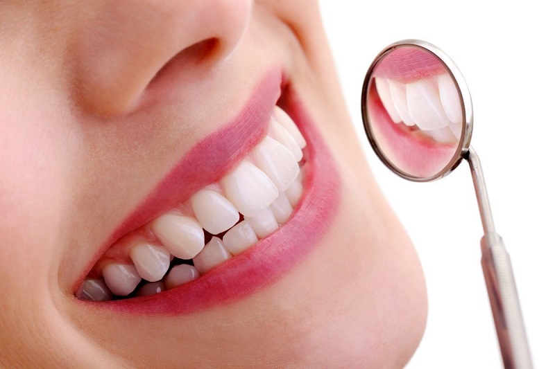 Bọc răng sứ là phương pháp nha khoa thẩm mỹ phổ biến 