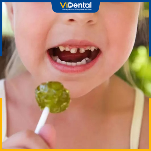 Em bé ăn kẹo bị sâu răng là tình trạng thường gặp